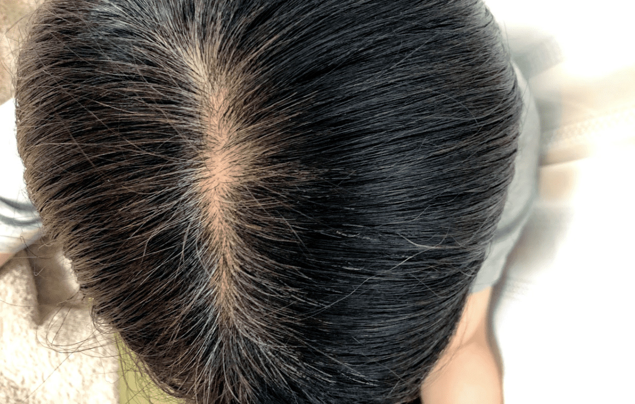 features-of-hair-color-treatment